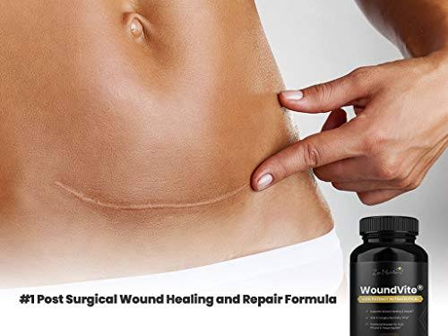 Scar Treatment 60ct S3510
