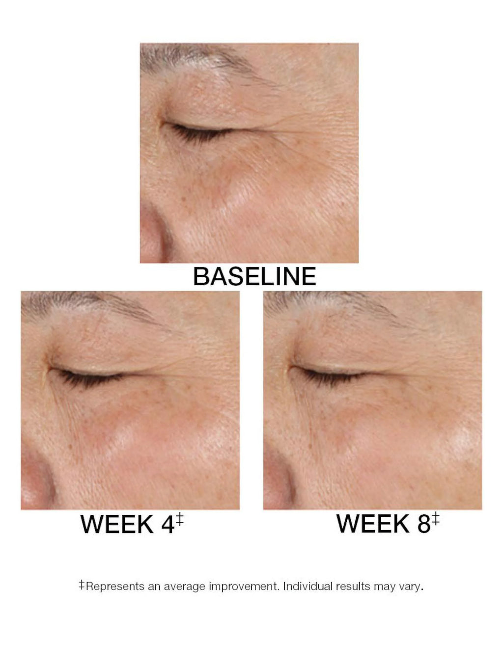 1.5 FL. OZ. Serum P653675
