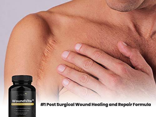 Scar Treatment 60ct S3510
