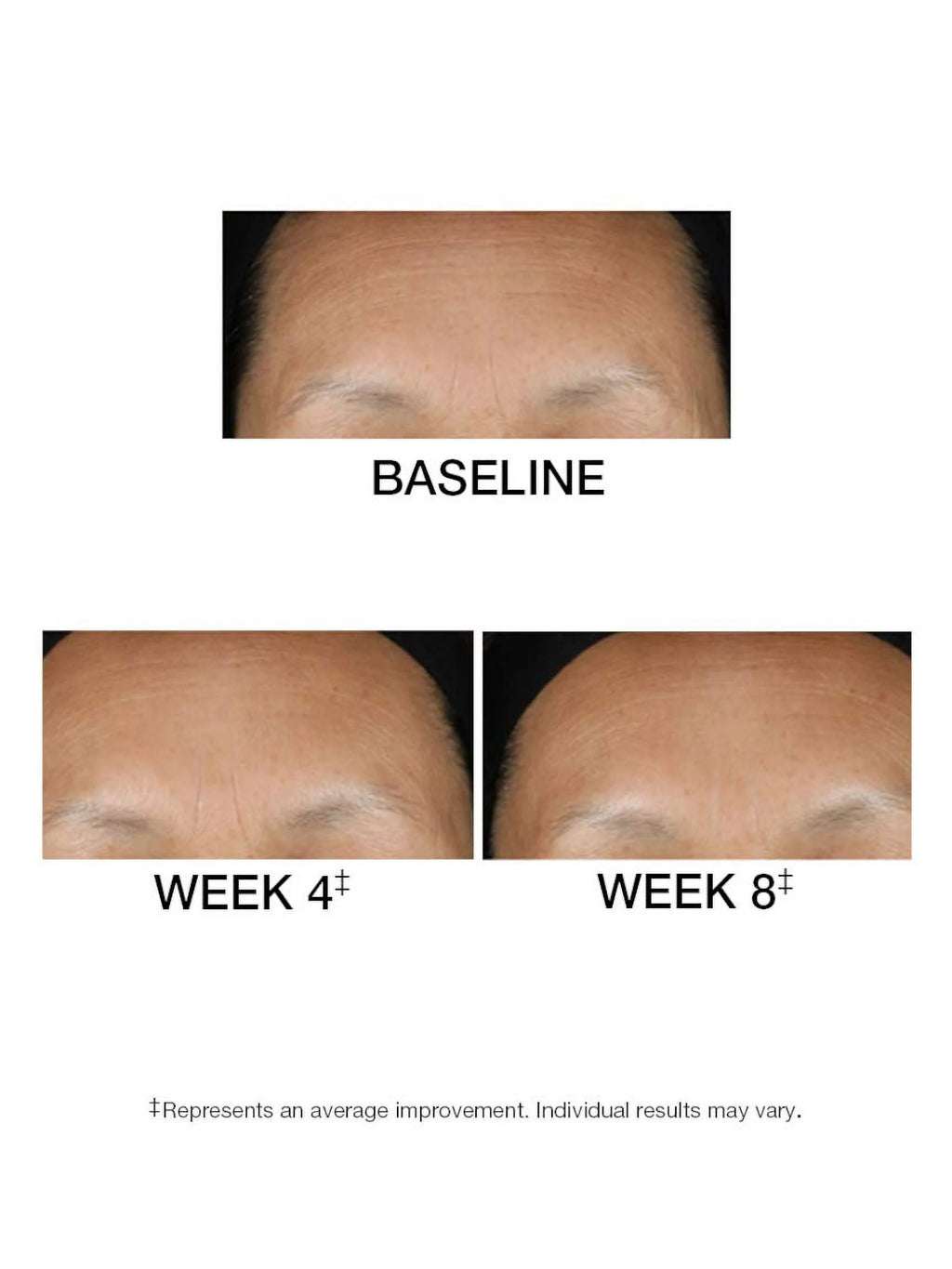 1.5 FL. OZ. Serum P653675