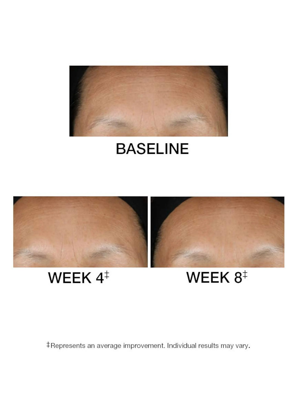 1.5 FL. OZ. Serum P653675
