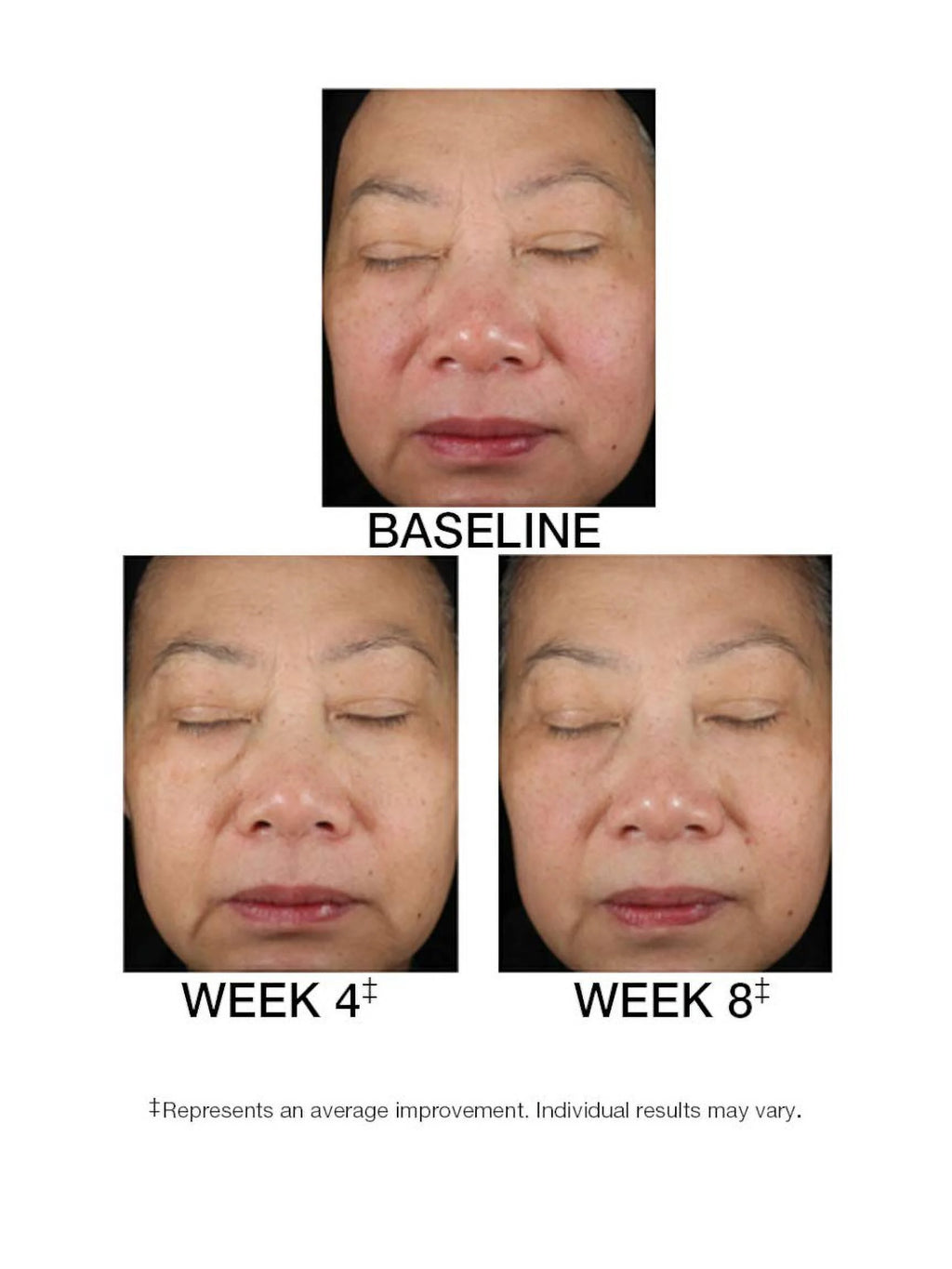 1.5 FL. OZ. Serum P653675